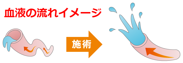 血液の流れイメージ